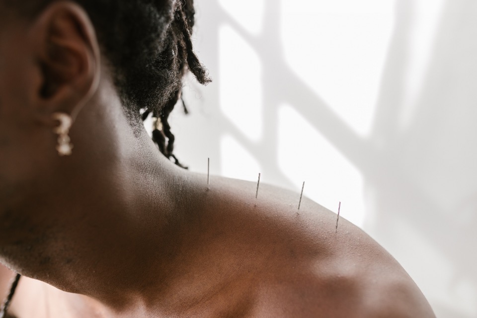 Using Acupuncture for Integrative Addiction Treatment